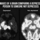 مقایسه تصویر مغز